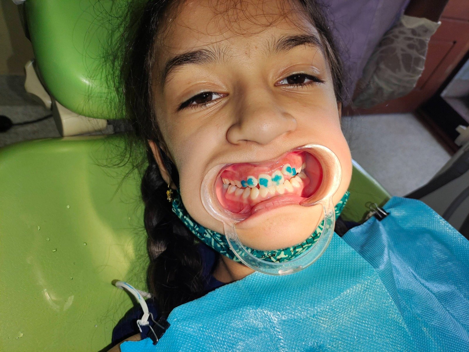 12. Clear Aligners & Invisible Orthodontics - Before