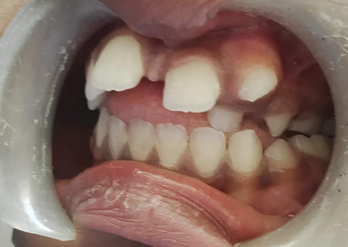 16. Oral & Maxillofacial Day-Care Surgery - After