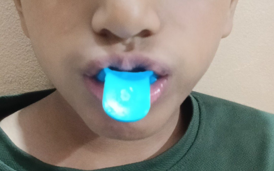 3. Preventive Dentistry & Fluoride Therapy